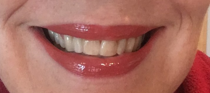 sephora-oct-2016-estee-edit-flash-photo-gloss