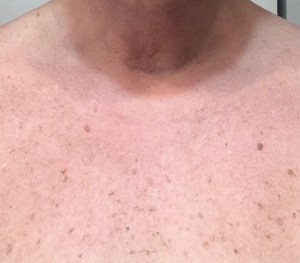 Gold Bond neck &amp; Chest cream 3-4-18 photo